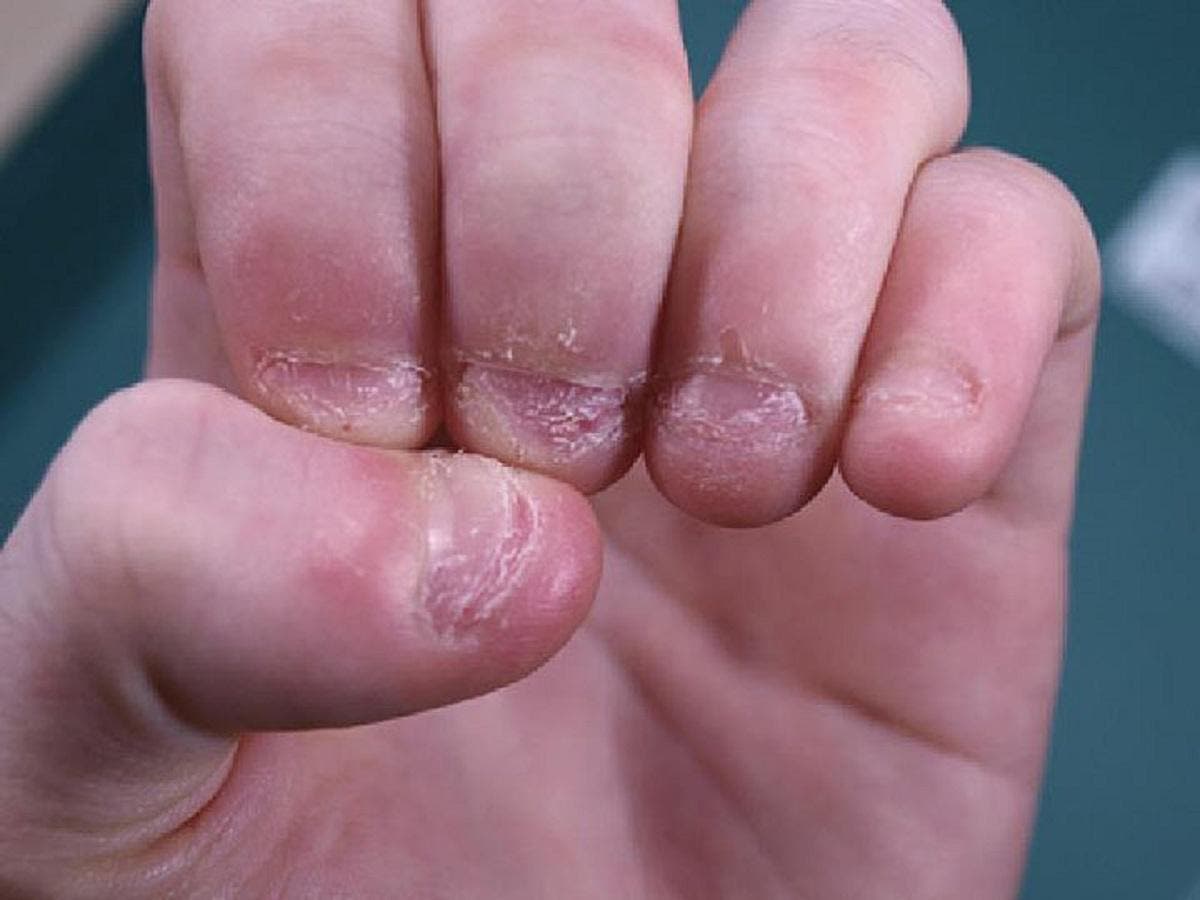 Детский маникюр: искореняем привычку грызть ногти