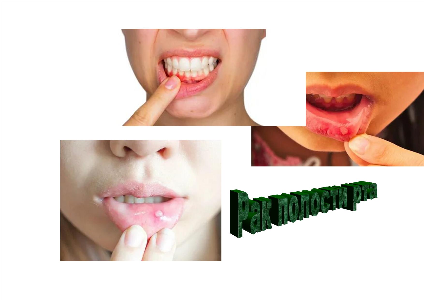 Здоровый рот должен быть зеленым